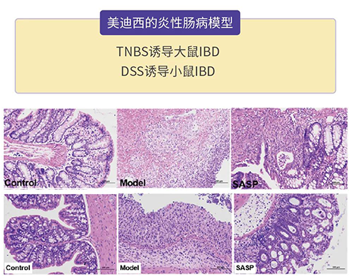 s36沙龙会的炎症性肠病模型