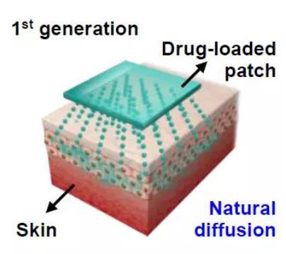 第一代透皮给药技术：通过药物的自然扩散.jpg