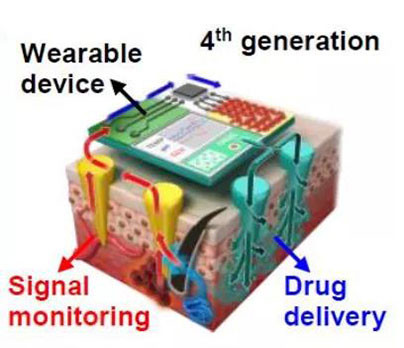 第四代透皮给药技术：在可穿戴设备的帮助下，用于患者定制治疗.jpg