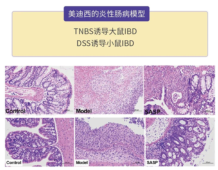 s36沙龙会的炎性肠病模型.png